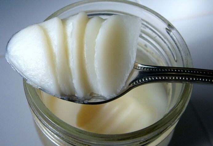 lard for the preparation of homemade ointment for the treatment of fungus on the feet