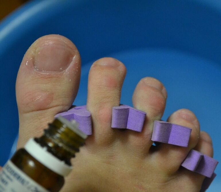 treatment