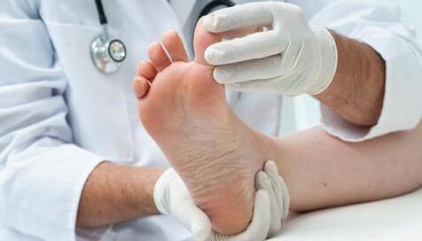 Fungus treatment