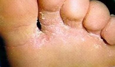 How to recognize your finger sponge