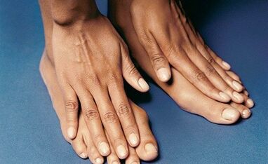 How to treat fingers on the fingers